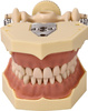 Teeth model with plastic articulator for clinical practice, with replacement teeth (32 teeth)