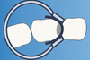Ring for sectional matrices D-Ring - TOR VM